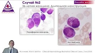 Обзор клинических случаев с лейкопениями. Трейлер к видеозаписи занятия №2, (Май 2023).