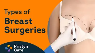 What are the types of Breast Surgeries