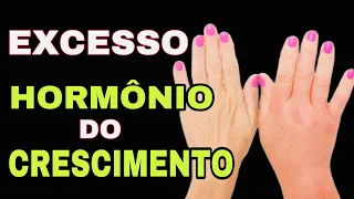 7 SINAIS no CORPO de EXCESSO DE HORMÔNIO DO CRESCIMENTO QUE VOCÊ NÃO PODE IGNORAR (GH - Acromegalia)