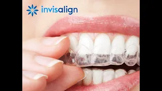 Какие виды прикуса можно исправить с помощью элайнеров Invisalign?