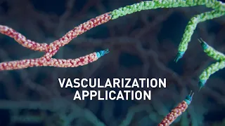 Vascularization Application