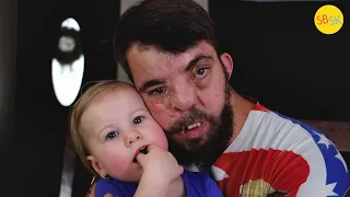 Disabled and Abandoned at Birth (Now He's a Father of 5)