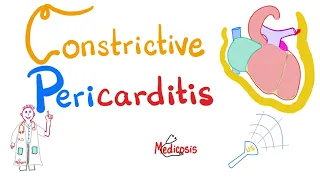 Constrictive Pericarditis | Causes, Symptoms, Signs, Diagnosis & Management | Cardiology