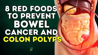 8 Red Foods To Prevent Bowel Cancer And Colon Polyps