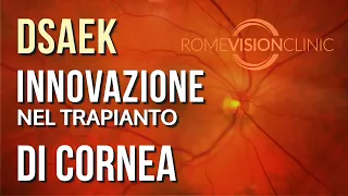 DSAEK - Chirurgia di ultima generazione per il trattamento delle disfunzioni dell'endotelio corneale