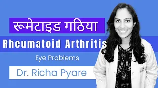 Rheumatoid Arthritis & eye problems?  Dr. Richa Pyare @shroffeyecentre.official