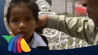 Niño de 4 años pierde un ojo por accidente en casa | Noticias del Estado de México