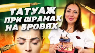 Татуаж при шрамах на бровях / советы Валиды Мамедовой