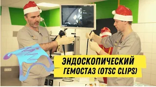 OTSC. Обучающее видео. Тренинг-Курс Эндо Старс. Endo Stars LLC.