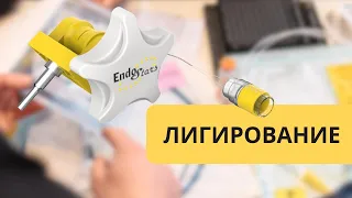 Клинический случай применения лигатора Эндо Старс (Россия)