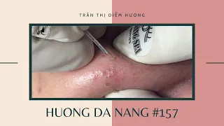 #157 | Huong Da Nang