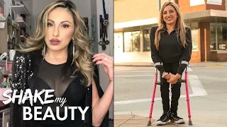 Spina Bifida Doesn’t Stop Me Being Beautiful | SHAKE MY BEAUTY