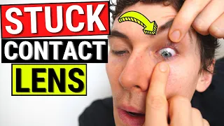 How to Remove a STUCK Contact Lens from the Eye