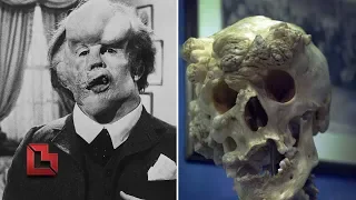 Elephant Man Joseph Merrick's grave found