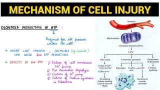 Cell Injury (2/2) | Mechanism of  Cell Injury | Pathology | EOMS