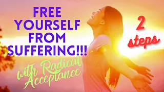 Radical acceptance will set you free