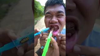 Người Chị Tốt Bụng làm Bác Sĩ Khám Răng cho Em Ăn Kẹo Mút Sâu Răng / Funny Video Eat Candy