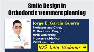 Smile Design in Orthodontic Treatment Planning