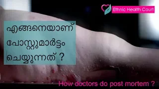 How doctors do post mortem ? | ഡോകടർ എങ്ങനെയാണ് പോസ്റ്റുമാർട്ടം ചെയ്യുന്നത് ? | Ethnic Health Court