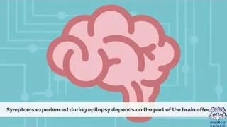 EPILEPSY, Causes, Signs and Symptoms, Diagnosis and Treatment.