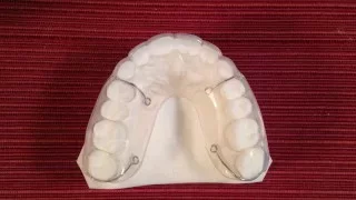 Hybretain Orthodontic Retainers