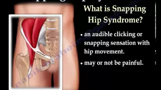 Snapping Hip Syndrome - Everything You Need To Know - Dr. Nabil Ebraheim