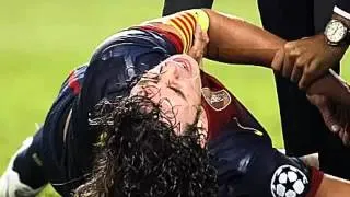 Puyol breaks arm