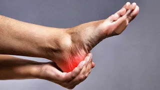 Cómo curar el dolor del talón: fascitis plantar. 4 Métodos.