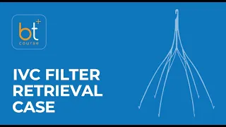 Course Preview: Sinai IVC Filter Retrieval Case