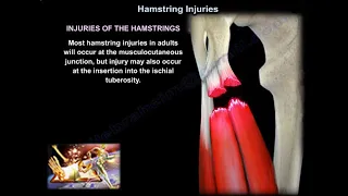 Hamstrings Injuries - Everything You Need To Know - Dr. Nabil Ebraheim