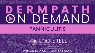 Panniculitis