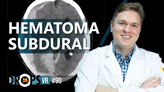 HEMATOMA SUBDURAL PT. 1