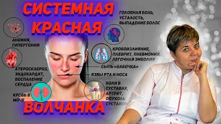 💊 Красная волчанка 🔴 причины симптомы, диагноз 👉 Системная красная волчанка ✅