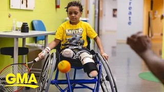 Michigan boy had both of his legs amputated after strep and influenza A infections