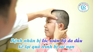 Bệnh nhân bị lóc da đầu kể lại toàn bộ quá trình bị tai nạn