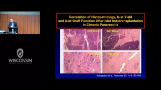 Journey from Islet Transplantation to Complement Inhibition as a Donor Pretreatment Strategy