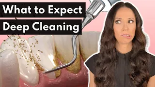 What To Expect From a DEEP Cleaning at the Dentist