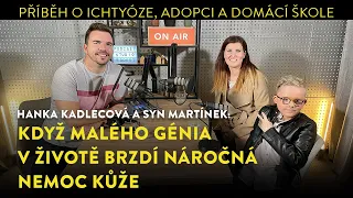 Šťastný Martínek zarůstá šupinami kůže. Ichtyóza je nemoc na plný úvazek | Podcast Slyšíme se