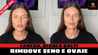 Cancro, Bianca Balti rimuove seno e ovaie