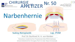 Narbenhernie Sublay-Netzplastik - Lap. IPOM CHIRURGIE - MILOS APPetizer Nr. 50