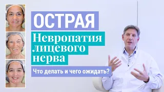 Паралич Белла: Что делать и чего ожидать при острой невропатии (неврите) лицевого нерва