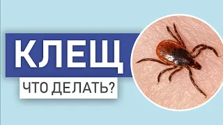 Что делать, если УКУСИЛ КЛЕЩ. Как вытащить? Чем опасны клещи. Как от них защититься. Советы врача