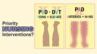 PAD vs  PVD   Top 2 tested nursing treatments, memory tricks   Exams & NCLEX