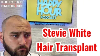 ‘Stevie White - Hair Transplant at The British Hair Clinic’