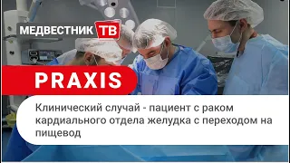 Praxis: Рак кардиального отдела желудка с переходом на пищевод