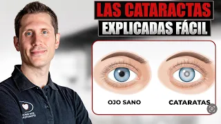 What are CATARACTS?