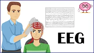 EEG (Electroencephalogram) - How It Is Done, Indications, Types Of EEG - Patient Education