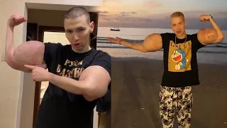 Russian "Hulk" Shows Off His Fake Muscles