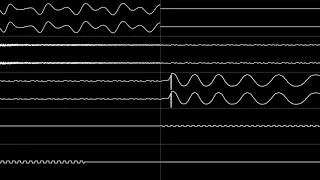 Yuzo Koshiro - “Streets of Rage (MD/Genesis)” Full Soundtrack [Oscilloscope View]