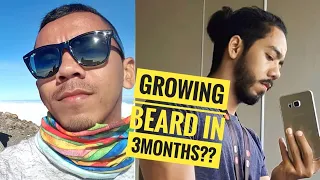My beard journey (almost 4 months) MINOXIDIL progress and results